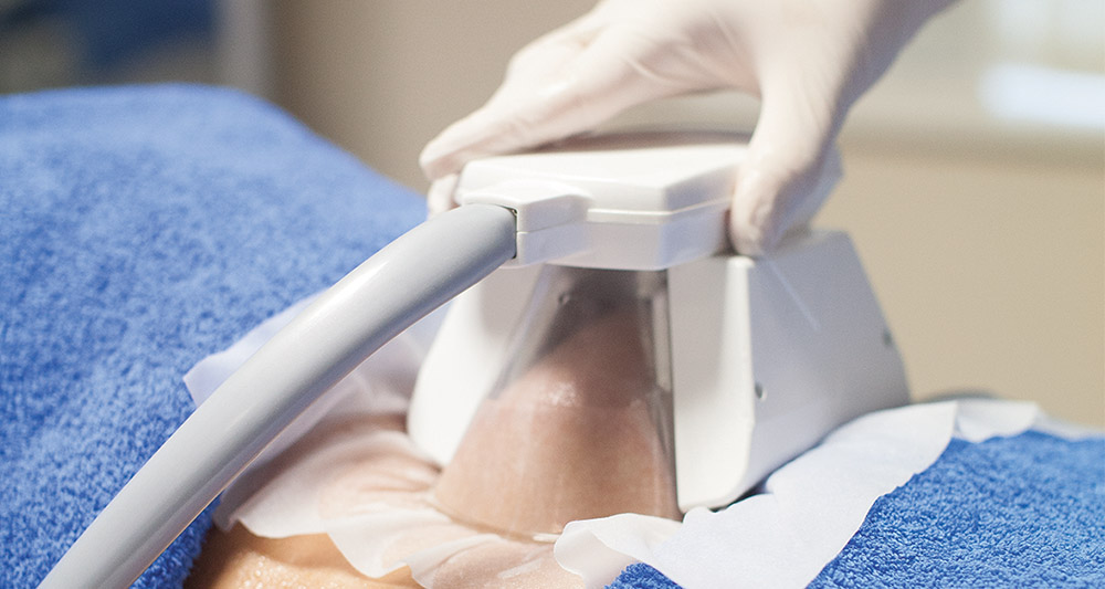 How Fat Freezing and HIFU Work Together? 2 Multiple Areas in One Session HIFU and Fat Freezing Wilmslow