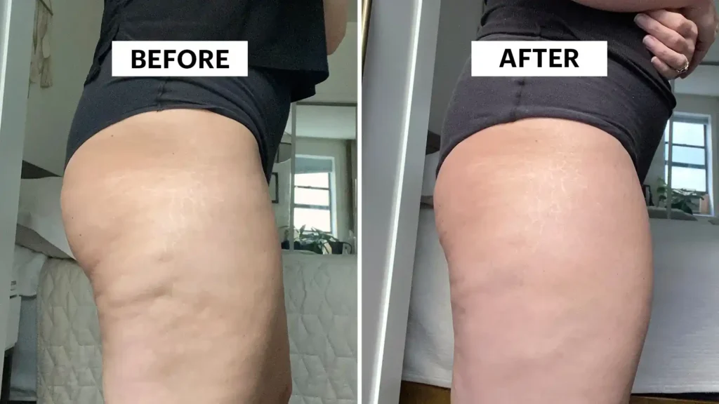 Sculpting Your Bum: Can Toning Exercises Really Reduce Cellulite? 1 Do Toning Exercise Wilmslow Really Tackle Cellulite?