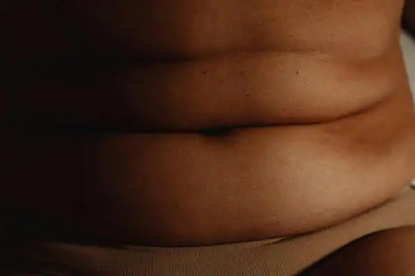 The Hidden Connection: How Stress Shapes Your Fitness and Body Composition 3 image of what stress can do on the stomach area and how Lipo 360 Wilmslow can help to change your body shape.